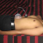 NABHI PUMP - SURGICAL FOR NEVAL / NABHI