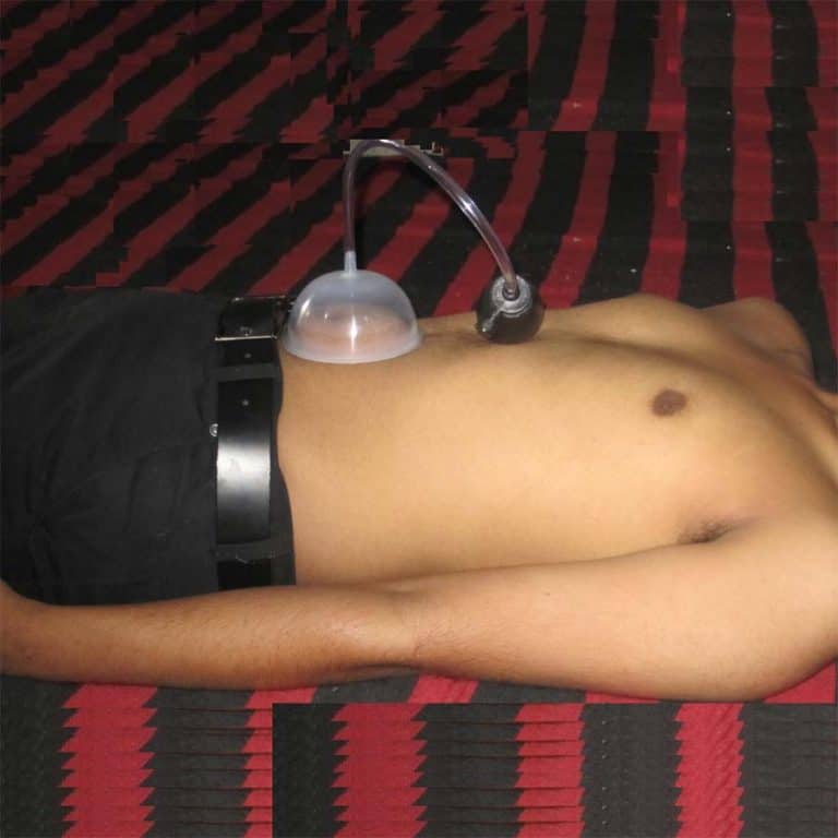 NABHI PUMP - SURGICAL FOR NEVAL / NABHI