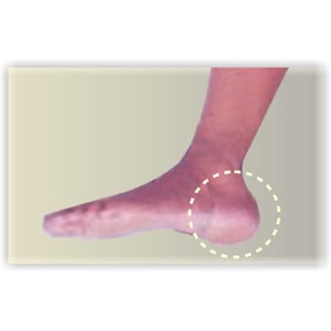 HEAL  ANKLE MAGNETIC BELT